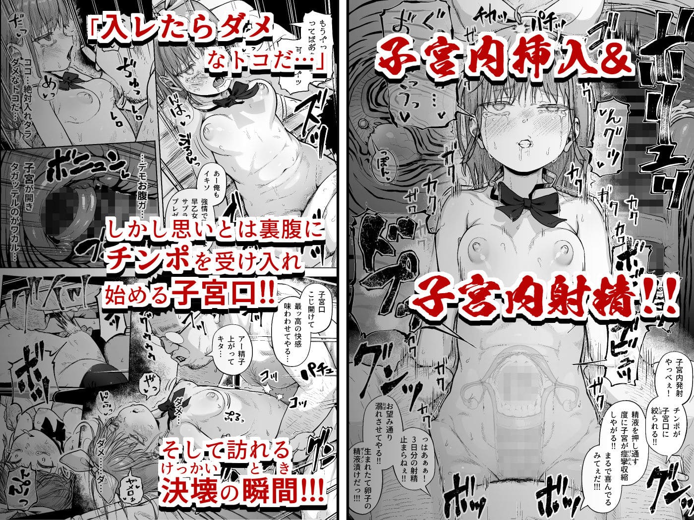 子宮内挿入